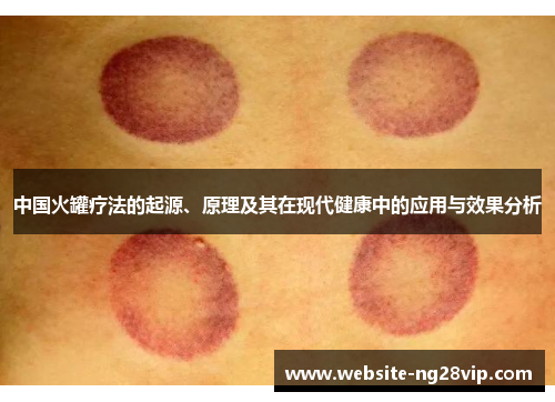 中国火罐疗法的起源、原理及其在现代健康中的应用与效果分析